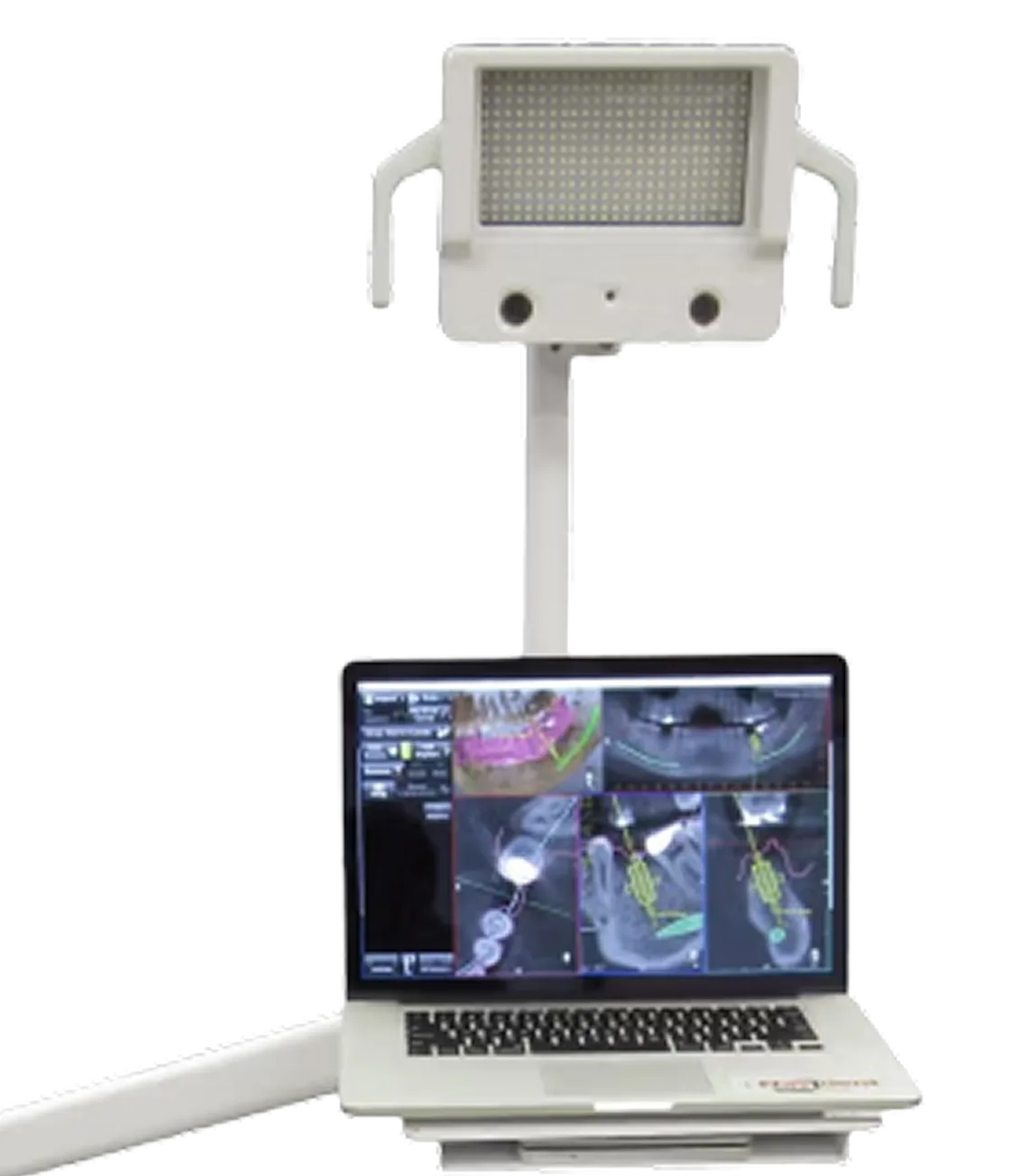 Navident 3.0 navigation device