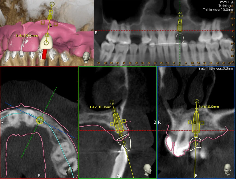 Blog 2 Dynamic Navigation 2 - Marks Biotech