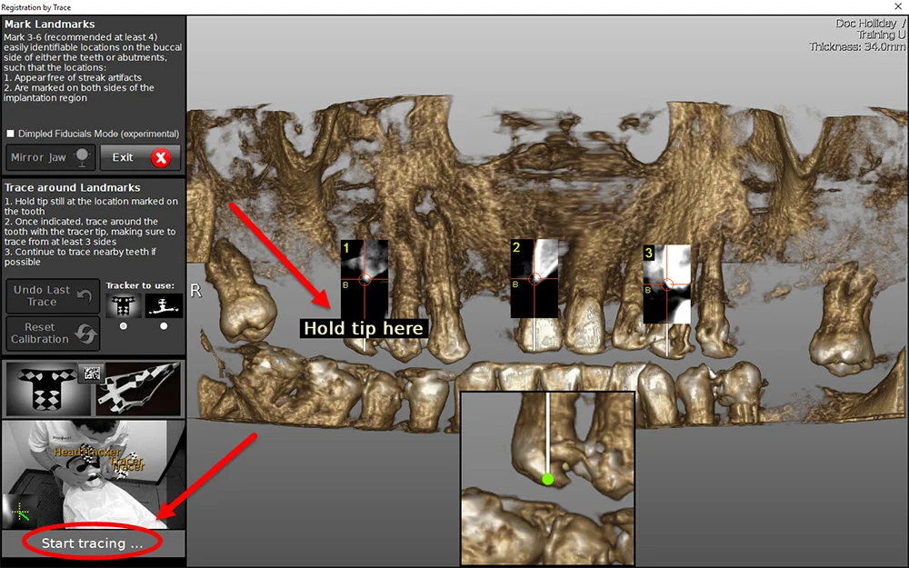 Blog 2 Dynamic Navigation 7 - Marks Biotech